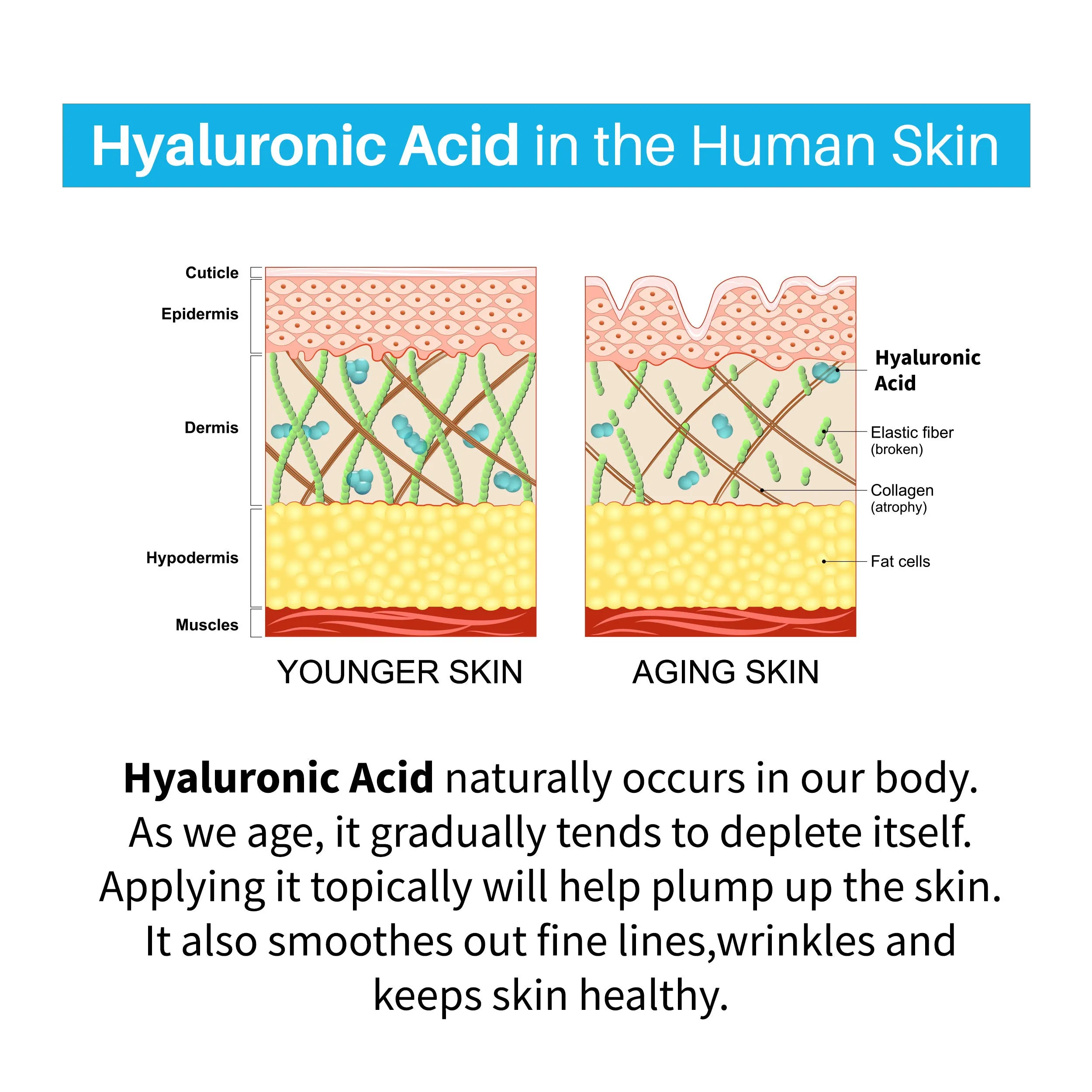 DermDoc 1% Pure Hyaluronic Acid Moisturizing Face Cream (50 gm) | hyaluronic acid moisturizer | face moisturizer for dry skin | oil free moisturizer | dry skin face cream | face cream for dry skin | hydrating moisturizer